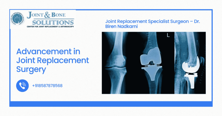 Read more about the article Advancement in Joint Replacement Surgery