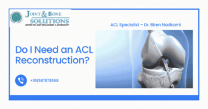 Do I Need an ACL Reconstruction