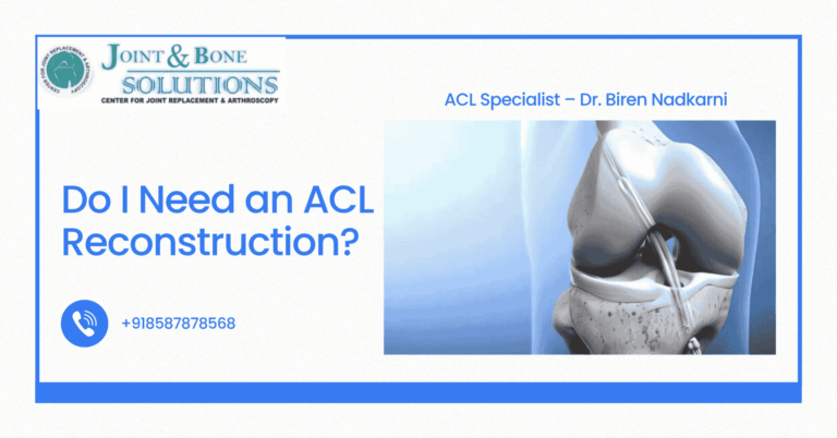 Read more about the article Do I Need an ACL Reconstruction?