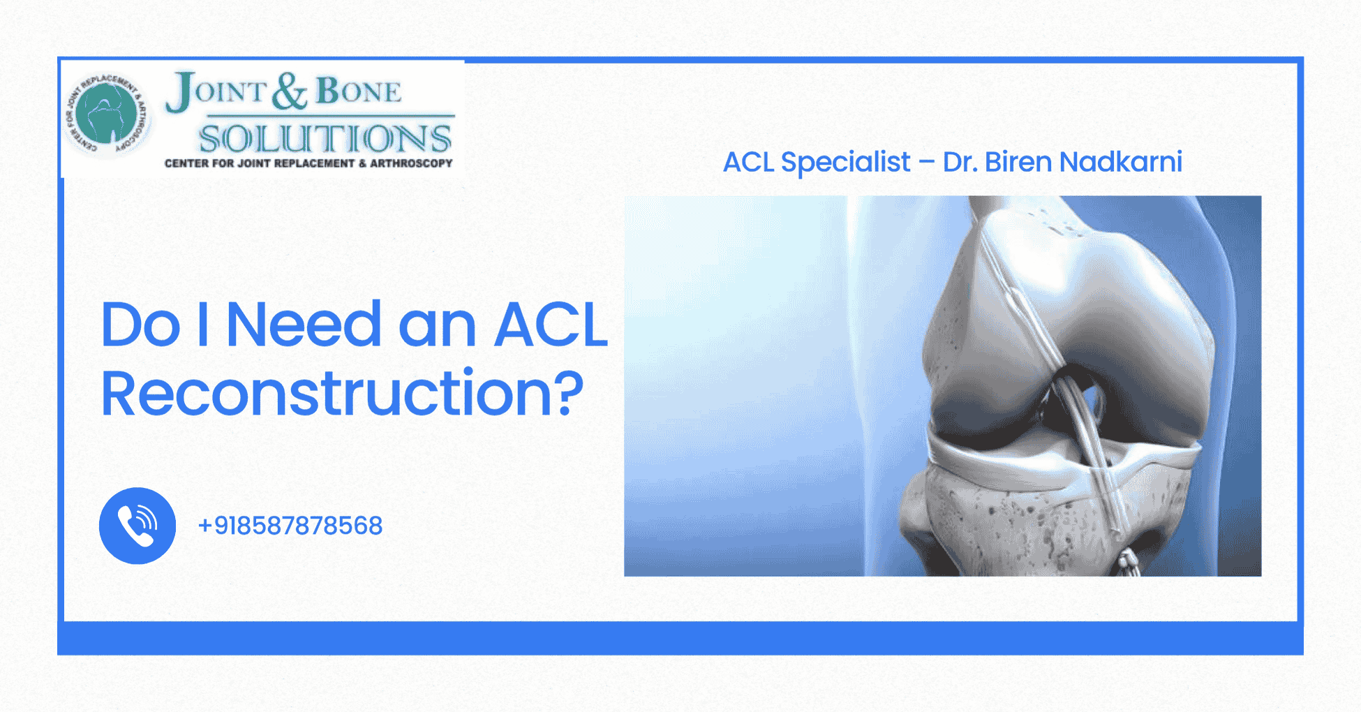 Read more about the article Do I Need an ACL Reconstruction?