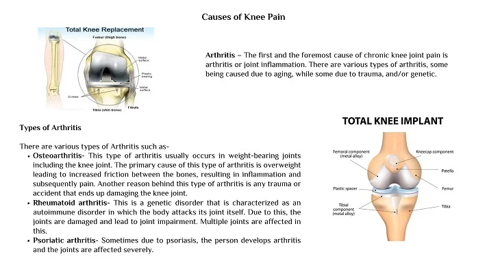 Causes of Knee Pain - Best Knee Replacement Surgeon in Delhi - Dr. Biren Nadkarni