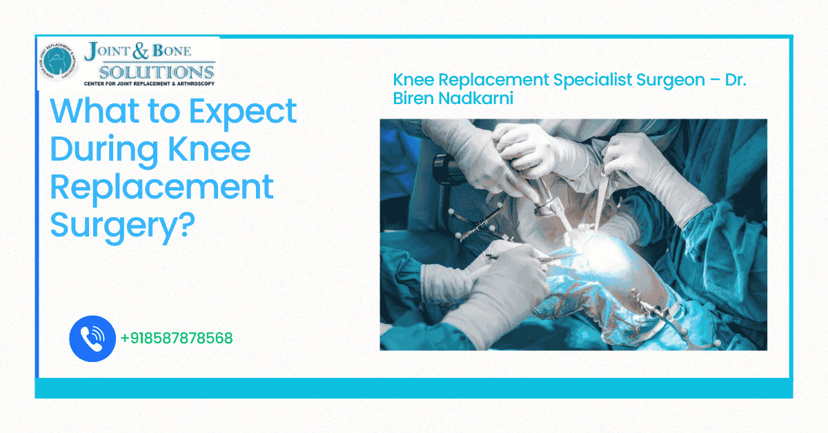 Read more about the article What to Expect During Knee Replacement Surgery?