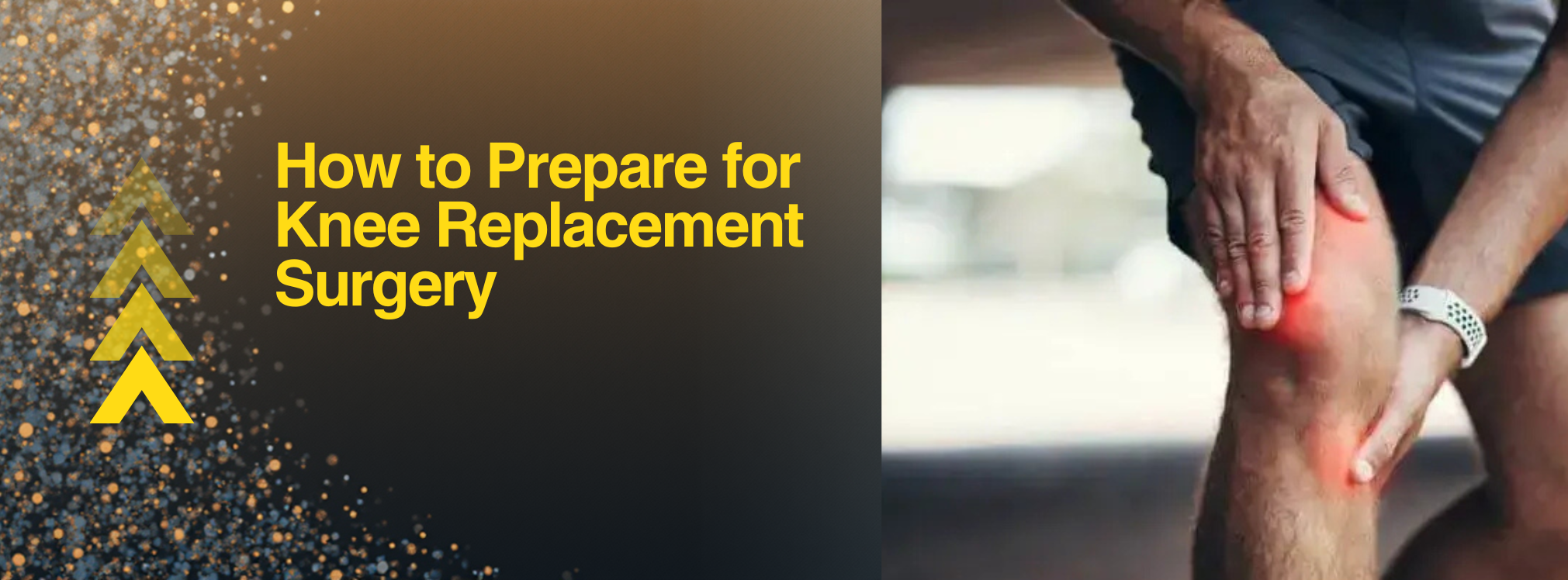 Read more about the article <strong>How to Prepare for Knee Replacement Surgery</strong>