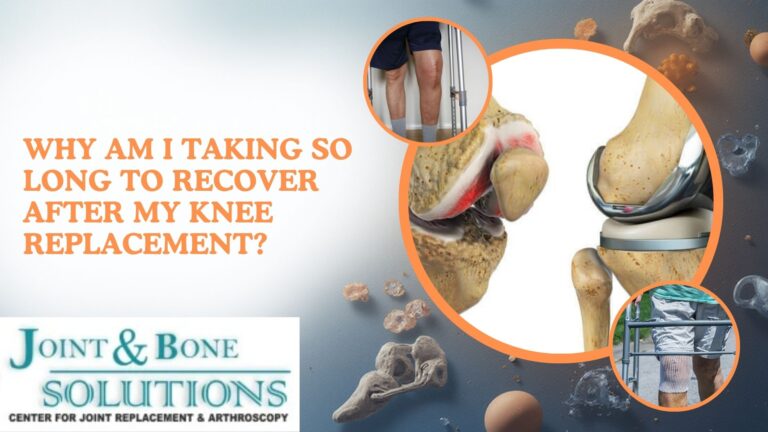 Read more about the article Why am I taking so long to recover after my knee replacement?