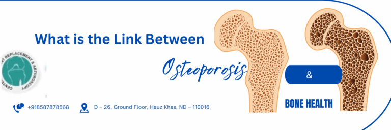Read more about the article What is the Link Between Osteoporosis and Bone Health?