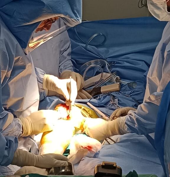 Dr-Biren-Nadkarni-performing-robotic-knee-replacement-surgery-8.jpg